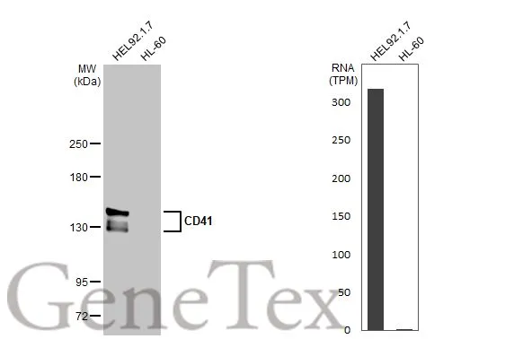 CD41 antibody [HL2052]