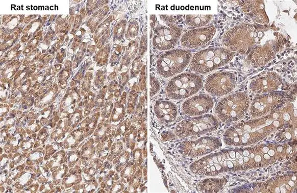 TBC1D5 antibody [HL2054] detects TBC1D5 protein by immunohistochemical analysis. Sample: Paraffin-embedded rat tissues. TBC1D5 stained by TBC1D5 antibody [HL2054] (GTX637958) diluted at 1:100. Antigen Retrieval: Citrate buffer, pH 6.0, 15 min
