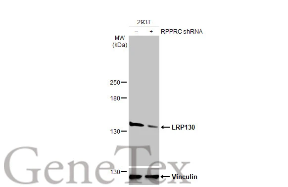 Non-transfected (–) and transfected (+) 293T whole cell extracts (30 μg) were separated by 5% SDS-PAGE, and the membrane was blotted with LRP130 antibody [HL2056] (GTX637960) diluted at 1:1000. The HRP-conjugated anti-rabbit IgG antibody (GTX213110-01) was used to detect the primary antibody.