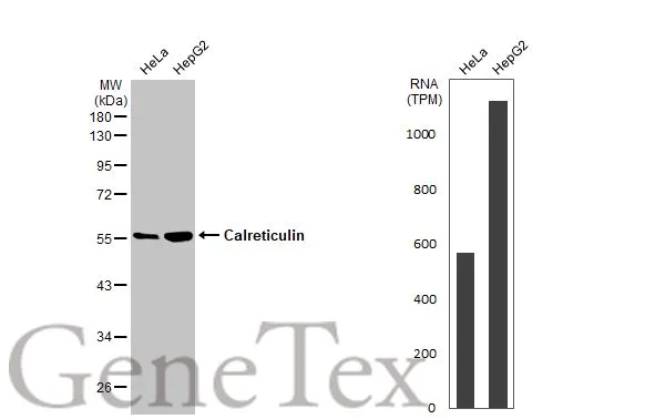 Various whole cell extracts (30 μg) were separated by 10% SDS-PAGE, and the membrane was blotted with Calreticulin antibody [HL2057] (GTX637961) diluted at 1:1000. The HRP-conjugated anti-rabbit IgG antibody (GTX213110-01) was used to detect the primary antibody. Corresponding RNA expression data for the same cell lines are based on Human Protein Atlas program.