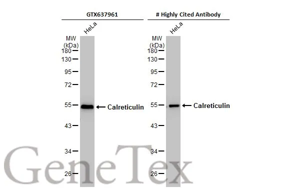 Whole cell extract (30 μg) was separated by 10% SDS-PAGE, and the membranes were blotted with Calreticulin antibody [HL2057] (GTX637961) diluted at 1:1000 and competitor's antibody (# Highly Cited Antibody) diluted at 1:1000. The HRP-conjugated anti-rabbit IgG antibody (GTX213110-01) was used to detect the primary antibody. *The competitor is not affiliated with GeneTex and does not endorse this product.