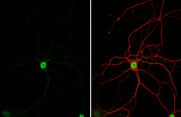 HMGB1 antibody [HL2059] detects HMGB1 protein at nucleus by immunofluorescent analysis. Sample: DIV9 rat E18 primary hippocampal neuron cells were fixed in 4% paraformaldehyde at RT for 15 min. Green: HMGB1 stained by HMGB1 antibody [HL2059] (GTX637963) diluted at 1:250. Red: Tau, an axon marker, stained by Tau antibody [GT287] (GTX634809) diluted at 1:500.
