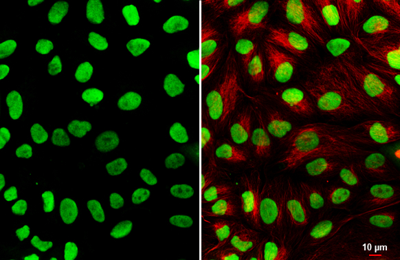 HMGB1 antibody [HL2060] detects HMGB1 protein by immunofluorescent analysis. Sample: MDCK cells were fixed in 4% paraformaldehyde at RT for 15 min. Green: HMGB1 stained by HMGB1 antibody [HL2060] (GTX637964) diluted at 1:500. Red: alpha Tubulin, a cytoskeleton marker, stained by alpha Tubulin antibody [GT114] (GTX628802) diluted at 1:1000.