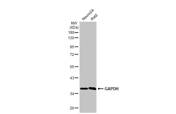 Various whole cell extracts (30 μg) were separated by 10% SDS-PAGE, and the membrane was blotted with GAPDH antibody [HL2062] (GTX637966) diluted at 1:5000. The HRP-conjugated anti-rabbit IgG antibody (GTX213110-01) was used to detect the primary antibody.