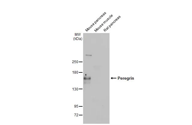 Various tissue extracts (50 μg) were separated by 5% SDS-PAGE, and the membrane was blotted with Peregrin antibody [HL2064] (GTX637968) diluted at 1:1000. The HRP-conjugated anti-rabbit IgG antibody (GTX213110-01) was used to detect the primary antibody, and the signal was developed with Trident ECL plus-Enhanced.