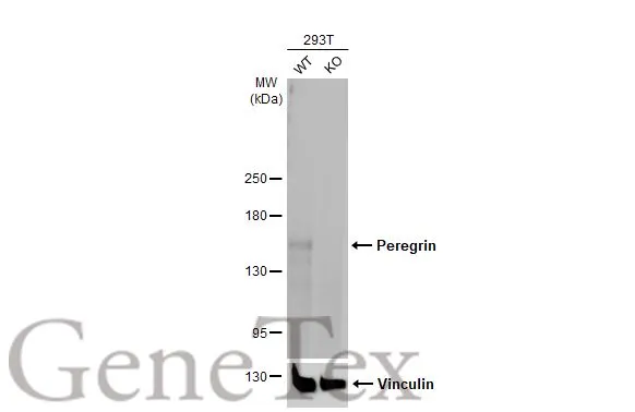 Wild-type (WT) and BRPF1 knockout (KO) 293T cell extracts (5 μg) were separated by 5% SDS-PAGE, and the membrane was blotted with Peregrin antibody [HL2064] (GTX637968) diluted at 1:1000. The HRP-conjugated anti-rabbit IgG antibody (GTX213110-01) was used to detect the primary antibody, and the signal was developed with Trident femto Western HRP Substrate.