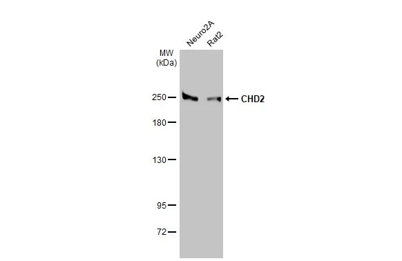Various whole cell extracts (30 μg) were separated by 5% SDS-PAGE, and the membrane was blotted with CHD2 antibody [HL2066] (GTX637970) diluted at 1:1000. The HRP-conjugated anti-rabbit IgG antibody (GTX213110-01) was used to detect the primary antibody.