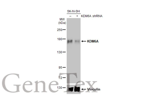 Non-transfected (–) and transfected (+) SK-N-SH whole cell extracts (42 μg) were separated by 5% SDS-PAGE, and the membrane was blotted with KDM6A antibody [HL2068] (GTX637972) diluted at 1:1000. The HRP-conjugated anti-rabbit IgG antibody (GTX213110-01) was used to detect the primary antibody.