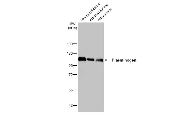Human plasma, mouse plasma and rat plasma (30 μg) were separated by 7.5% SDS-PAGE, and the membrane was blotted with Plasminogen antibody [HL2071] (GTX637979) diluted at 1:1000. The HRP-conjugated anti-rabbit IgG antibody (GTX213110-01) was used to detect the primary antibody.
