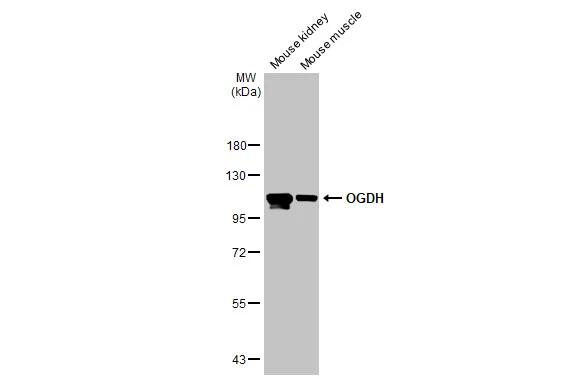 Various tissue extracts (50 μg) were separated by 7.5% SDS-PAGE, and the membrane was blotted with OGDH antibody [HL2072] (GTX637980) diluted at 1:1000. The HRP-conjugated anti-rabbit IgG antibody (GTX213110-01) was used to detect the primary antibody.