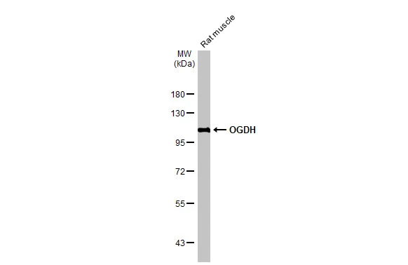 Rat tissue extract (50 μg) was separated by 7.5% SDS-PAGE, and the membrane was blotted with OGDH antibody [HL2072] (GTX637980) diluted at 1:1000. The HRP-conjugated anti-rabbit IgG antibody (GTX213110-01) was used to detect the primary antibody.