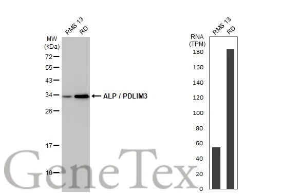 Various whole cell extracts (30 μg) were separated by 12% SDS-PAGE, and the membrane was blotted with ALP / PDLIM3 antibody [HL2075] (GTX637983) diluted at 1:1000. The HRP-conjugated anti-rabbit IgG antibody (GTX213110-01) was used to detect the primary antibody. Corresponding RNA expression data for the same cell lines are based on Human Protein Atlas program.