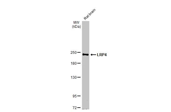 LRP4 antibody [HL2080]