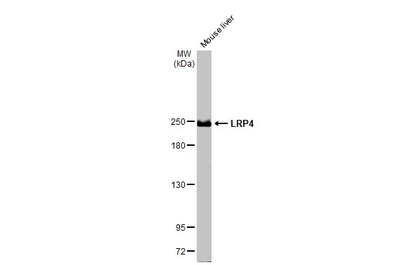 LRP4 antibody [HL2080]