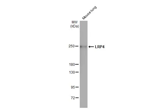 LRP4 antibody [HL2080]