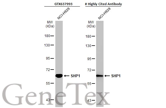 Whole cell extract (30 μg) was separated by 7.5% SDS-PAGE, and the membranes were blotted with SHP1 antibody [HL20845] (GTX637993) diluted at 1:1000 and competitor's antibody (#Highly competitor antibody) diluted at 1:1000. The HRP-conjugated anti-rabbit IgG antibody (GTX213110-01) was used to detect the primary antibody. *The competitor is not affiliated with GeneTex and does not endorse this product.
