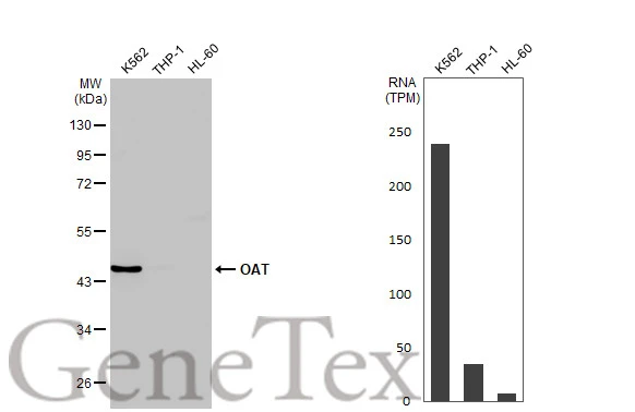 Various whole cell extracts (30 μg) were separated by 10% SDS-PAGE, and the membrane was blotted with OAT antibody [HL2087] (GTX637995) diluted at 1:1000. The HRP-conjugated anti-rabbit IgG antibody (GTX213110-01) was used to detect the primary antibody, and the signal was developed with Trident ECL plus-Enhanced. Corresponding RNA expression data for the same cell lines are based on Human Protein Atlas program.