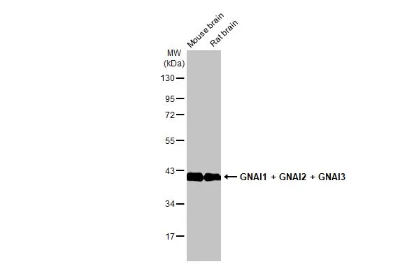 Various tissue extracts (50 μg) were separated by 10% SDS-PAGE, and the membrane was blotted with GNAI1 + GNAI2 + GNAI3 antibody [HL2092] (GTX638000) diluted at 1:1000. The HRP-conjugated anti-rabbit IgG antibody (GTX213110-01) was used to detect the primary antibody.