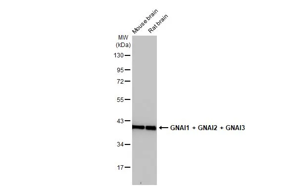 Various tissue extracts (50 μg) were separated by 10% SDS-PAGE, and the membrane was blotted with GNAI1 + GNAI2 + GNAI3 antibody [HL2093] (GTX638001) diluted at 1:1000. The HRP-conjugated anti-rabbit IgG antibody (GTX213110-01) was used to detect the primary antibody.