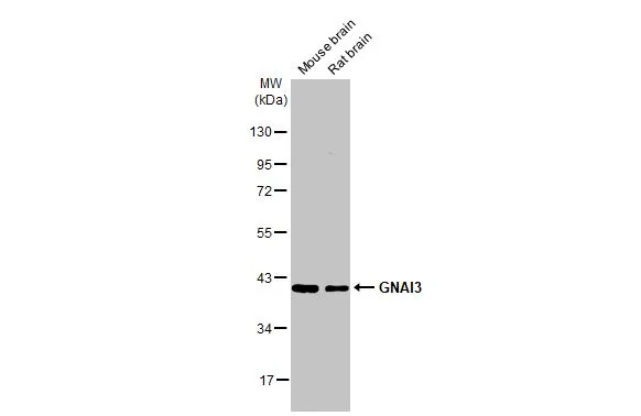 Various tissue extracts (50 μg) were separated by 10% SDS-PAGE, and the membrane was blotted with GNAI3 antibody [HL2096] (GTX638004) diluted at 1:1000. The HRP-conjugated anti-rabbit IgG antibody (GTX213110-01) was used to detect the primary antibody, and the signal was developed with Trident ECL plus-Enhanced.