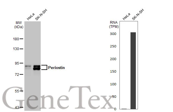 Various whole cell extracts (30 μg) were separated by 7.5% SDS-PAGE, and the membrane was blotted with Periostin antibody [HL2112] (GTX638084) diluted at 1:1000. The HRP-conjugated anti-rabbit IgG antibody (GTX213110-01) was used to detect the primary antibody. Corresponding RNA expression data for the same cell lines are based on Human Protein Atlas program.
