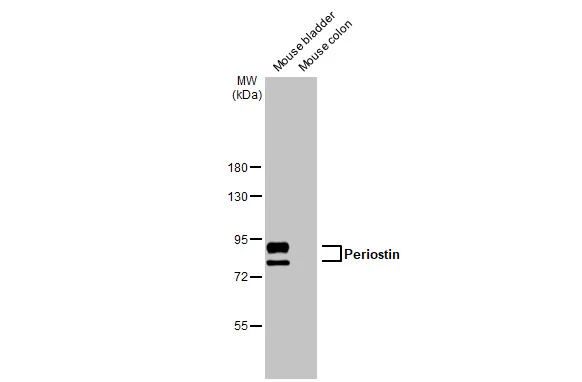 Various tissue extracts (50 μg) were separated by 7.5% SDS-PAGE, and the membrane was blotted with Periostin antibody [HL2112] (GTX638084) diluted at 1:1000. The HRP-conjugated anti-rabbit IgG antibody (GTX213110-01) was used to detect the primary antibody.