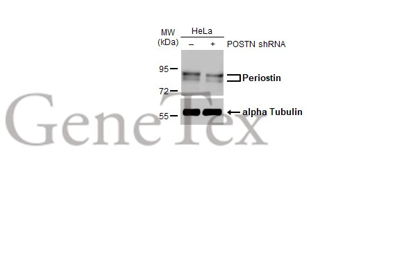 Non-transfected (–) and transfected (+) HeLa whole cell extracts (30 μg) were separated by 7.5% SDS-PAGE, and the membrane was blotted with Periostin antibody [HL2112] (GTX638084) diluted at 1:1000. The HRP-conjugated anti-rabbit IgG antibody (GTX213110-01) was used to detect the primary antibody.