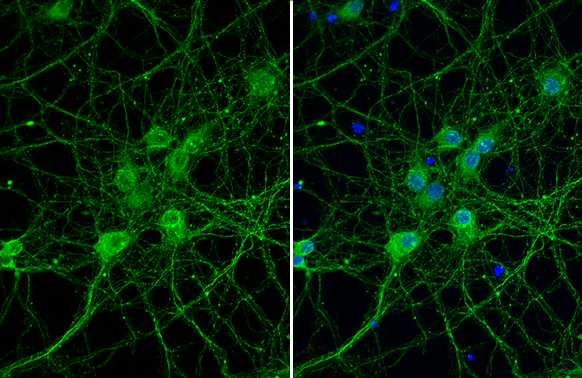 PIN1 antibody [HL2115] detects PIN1 protein at cytoplasm by immunofluorescent analysis. Sample: DIV9 rat E18 primary cortical neuron cells were fixed in 4% paraformaldehyde at RT for 15 min. Green: PIN1 stained by PIN1 antibody [HL2115] (GTX638087) diluted at 1:250. Blue: Fluoroshield with DAPI (GTX30920).