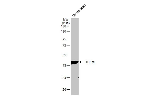 Mouse tissue extract (50 μg) was separated by 10% SDS-PAGE, and the membrane was blotted with TUFM antibody [HL2117] (GTX638089) diluted at 1:5000. The HRP-conjugated anti-rabbit IgG antibody (GTX213110-01) was used to detect the primary antibody.