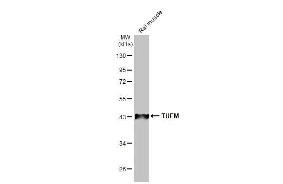 Rat tissue extract (50 μg) was separated by 10% SDS-PAGE, and the membrane was blotted with TUFM antibody [HL2117] (GTX638089) diluted at 1:5000. The HRP-conjugated anti-rabbit IgG antibody (GTX213110-01) was used to detect the primary antibody.