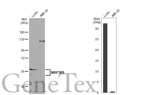 Various whole cell extracts (30 μg) were separated by 7.5% SDS-PAGE, and the membrane was blotted with MAP3K8 antibody [HL2118] (GTX638090) diluted at 1:10000. The HRP-conjugated anti-rabbit IgG antibody (GTX213110-01) was used to detect the primary antibody. Corresponding RNA expression data for the same cell lines are based on Human Protein Atlas program.