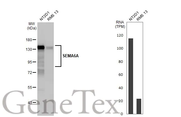Various whole cell extracts (30 μg) were separated by 7.5% SDS-PAGE, and the membrane was blotted with SEMA6A antibody [HL2120] (GTX638092) diluted at 1:1000. The HRP-conjugated anti-rabbit IgG antibody (GTX213110-01) was used to detect the primary antibody. Corresponding RNA expression data for the same cell lines are based on Human Protein Atlas program.