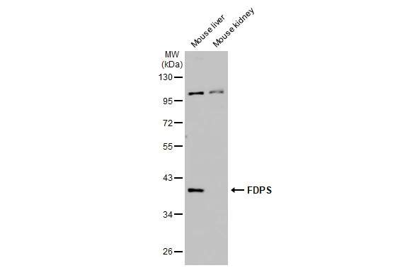 Various tissue extracts (50 μg) were separated by 10% SDS-PAGE, and the membrane was blotted with FDPS antibody [HL2123] (GTX638095) diluted at 1:2000. The HRP-conjugated anti-rabbit IgG antibody (GTX213110-01) was used to detect the primary antibody.