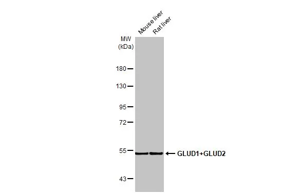Various tissue extracts (50 μg) were separated by 7.5% SDS-PAGE, and the membrane was blotted with GLUD1+GLUD2 antibody [HL2124] (GTX638096) diluted at 1:10000. The HRP-conjugated anti-rabbit IgG antibody (GTX213110-01) was used to detect the primary antibody.