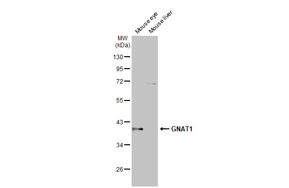 Various tissue extracts (50 μg) were separated by 10% SDS-PAGE, and the membrane was blotted with GNAT1 antibody [HL2126] (GTX638098) diluted at 1:1000. The HRP-conjugated anti-rabbit IgG antibody (GTX213110-01) was used to detect the primary antibody.