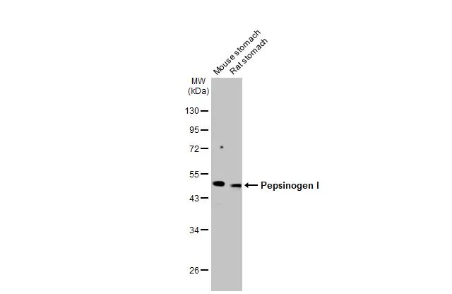 Various tissue extracts (50 μg) were separated by 10% SDS-PAGE, and the membrane was blotted with Pepsinogen I antibody [HL2137] (GTX638109) diluted at 1:1000. The HRP-conjugated anti-rabbit IgG antibody (GTX213110-01) was used to detect the primary antibody, and the signal was developed with Trident ECL plus-Enhanced.