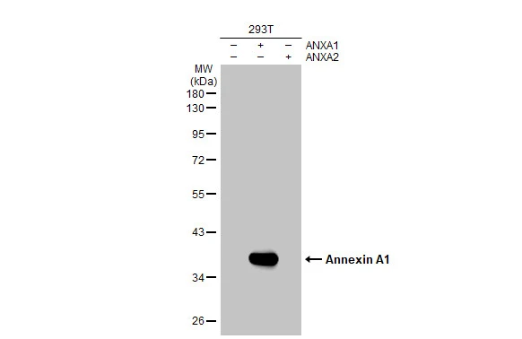 Non-transfected (–) and transfected (+) 293T whole cell extracts (30 μg) were separated by 10% SDS-PAGE, and the membrane was blotted with Annexin A1 antibody [HL2141] (GTX638119) diluted at 1:5000. The HRP-conjugated anti-rabbit IgG antibody (GTX213110-01) was used to detect the primary antibody.