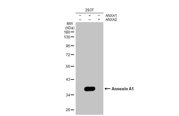 Non-transfected (–) and transfected (+) 293T whole cell extracts (30 μg) were separated by 10% SDS-PAGE, and the membrane was blotted with Annexin A1 antibody [HL2142] (GTX638120) diluted at 1:5000. The HRP-conjugated anti-rabbit IgG antibody (GTX213110-01) was used to detect the primary antibody.