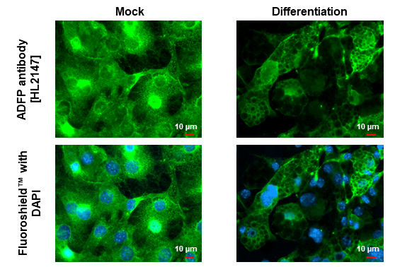ADFP antibody [HL2147] detects ADFP protein at lipid droplet by immunofluorescent analysis. Sample: Mock and differentiated 3T3-L1 cells were fixed in 4% paraformaldehyde at RT for 15 min. Green: ADFP stained by ADFP antibody [HL2147] (GTX638125) diluted at 1:500. Blue: Fluoroshield with DAPI (GTX30920).