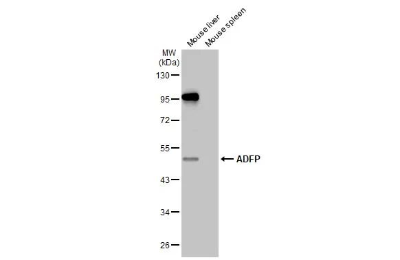 Various tissue extracts (50 μg) were separated by 10% SDS-PAGE, and the membrane was blotted with ADFP antibody [HL2147] (GTX638125) diluted at 1:1000. The HRP-conjugated anti-rabbit IgG antibody (GTX213110-01) was used to detect the primary antibody.