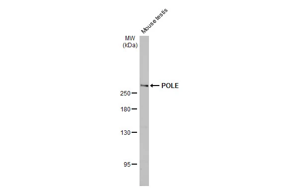 POLE antibody [HL2150]