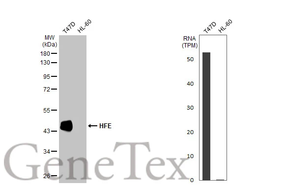 Various whole cell extracts (30 μg) were separated by 10% SDS-PAGE, and the membrane was blotted with HFE antibody [HL2155] (GTX638133) diluted at 1:1000. The HRP-conjugated anti-rabbit IgG antibody (GTX213110-01) was used to detect the primary antibody. Corresponding RNA expression data for the same cell lines are based on Human Protein Atlas program.
