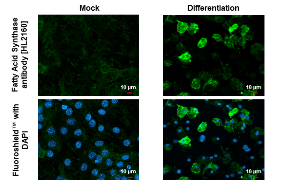 Fatty Acid Synthase antibody [HL2160] detects Fatty Acid Synthase protein at lipid droplet by immunofluorescent analysis. Sample: Mock and differentiated 3T3-L1 cells were fixed in 4% paraformaldehyde at RT for 15 min. Green: Fatty Acid Synthase stained by Fatty Acid Synthase antibody [HL2160] (GTX638138) diluted at 1:500. Blue: Fluoroshield with DAPI (GTX30920).