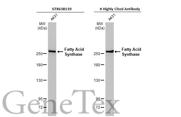 Whole cell extract (30 μg) was separated by 5% SDS-PAGE, and the membranes were blotted with Fatty Acid Synthase antibody [HL2161] (GTX638139) diluted at 1:1000 and competitor's antibody (#Highly competitor antibody) diluted at 1:1000. The HRP-conjugated anti-rabbit IgG antibody (GTX213110-01) was used to detect the primary antibody. *The competitor is not affiliated with GeneTex and does not endorse this product.