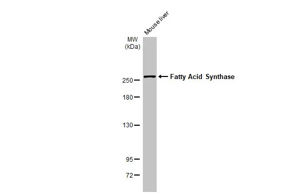 Mouse tissue extract (50 μg) was separated by 5% SDS-PAGE, and the membrane was blotted with Fatty Acid Synthase antibody [HL2161] (GTX638139) diluted at 1:1000. The HRP-conjugated anti-rabbit IgG antibody (GTX213110-01) was used to detect the primary antibody.