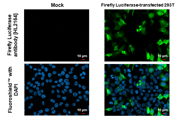 Anti-Firefly Luciferase antibody [HL2164] (GTX638142) | GeneTex