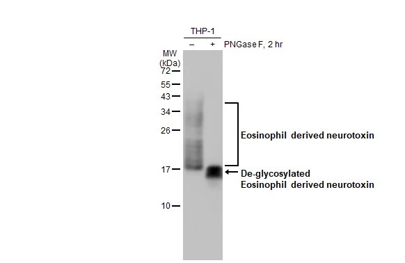 Untreated (–) and treated (+) THP-1 whole cell extract (30 μg) were separated by 15% SDS-PAGE, and the membrane was blotted with Eosinophil derived neurotoxin antibody [HL2166] (GTX638144) diluted at 1:1000. The HRP-conjugated anti-rabbit IgG antibody (GTX213110-01) was used to detect the primary antibody.