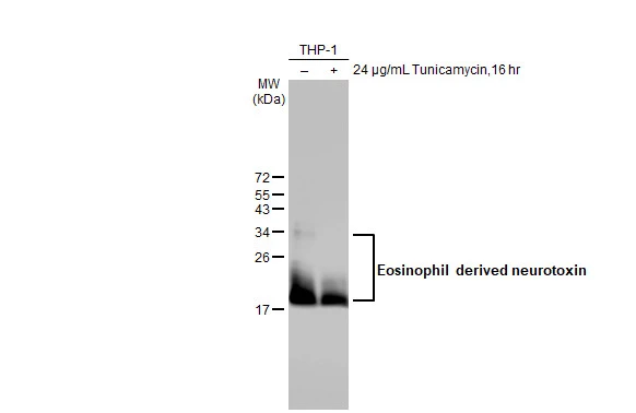 Untreated (–) and treated (+) THP-1 whole cell extracts (30 μg) were separated by 15% SDS-PAGE, and the membrane was blotted with Eosinophil derived neurotoxin antibody [HL2166] (GTX638144) diluted at 1:1000. The HRP-conjugated anti-rabbit IgG antibody (GTX213110-01) was used to detect the primary antibody.
