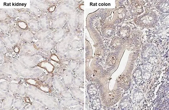 uPAR antibody [HL2169] detects uPAR protein by immunohistochemical analysis. Sample: Paraffin-embedded rat tissues. uPAR stained by uPAR antibody [HL2169] (GTX638173) diluted at 1:100. Antigen Retrieval: Citrate buffer, pH 6.0, 15 min