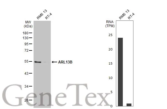 Various whole cell extracts (30 μg) were separated by 10% SDS-PAGE, and the membrane was blotted with ARL13B antibody [HL2173] (GTX638177) diluted at 1:1000. The HRP-conjugated anti-rabbit IgG antibody (GTX213110-01) was used to detect the primary antibody. Corresponding RNA expression data for the same cell lines are based on Human Protein Atlas program.